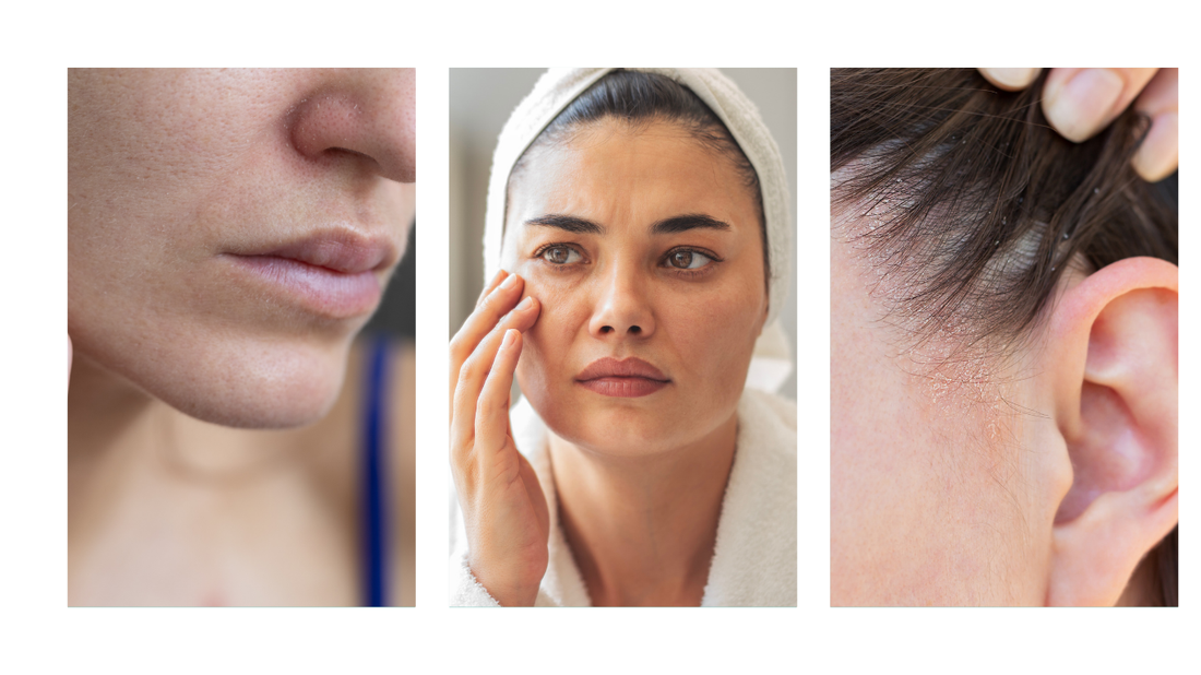 Bye-bye Spannungsgefühl: So pflegst du trockene Haut richtig